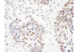 Immunohistochemistry (IHC) image for anti-MutS Homolog 6 (E. Coli) (MSH6) (AA 350-400) antibody (ABIN7454510) (MSH6 Antikörper  (AA 350-400))