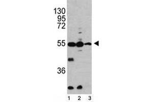 Western blot analysis of Caspase-2 antibody and 1) HL-60, 2) K562, 3) Ramos lysate. (Caspase 2 Antikörper  (AA 198-226))