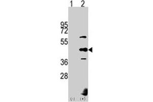 Western blot analysis of PDK2 (arrow) using PDK2 polyclonal antibody . (PDK2 Antikörper  (AA 378-407))
