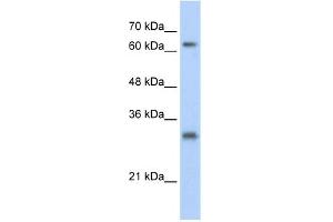 WB Suggested Anti-USP39 Antibody Titration:  0. (USP39 Antikörper  (N-Term))
