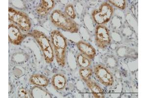 Image no. 1 for anti-Cyclin-Dependent Kinase 16 (CDK16) (AA 1-80) antibody (ABIN598860) (CDK16 Antikörper  (AA 1-80))