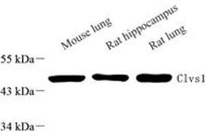 Western blot analysis of Clavesin 1 (ABIN7073517) at dilution of 1: 1000,Lane 1: Mouse lung tissue lysate,Lane 2: Rat ppocampus tissue lysate,Lane 3: Rat lung tissue lysate (Clavesin 1 Antikörper)