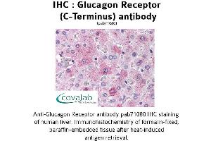 Image no. 1 for anti-Glucagon Receptor (GCGR) (C-Term) antibody (ABIN1734752) (Glucagon Receptor Antikörper  (C-Term))