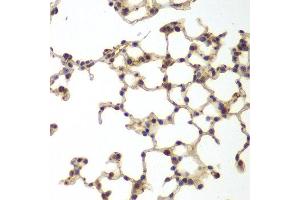 Immunohistochemistry of paraffin-embedded mouse lung using GSS antibody at dilution of 1:200 (400x lens). (Glutathione Synthetase Antikörper)