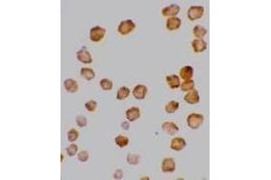Immunocytochemical staining of HeLa cells with DcR2 antibody at 10μg/ml. (DcR2 Antikörper)