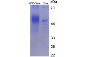 Image no. 2 for Major Basic Protein (AA 159-174) peptide (Ovalbumin) (ABIN5666269)