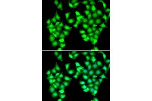 Immunofluorescence analysis of MCF7 cells using ATOH1 antibody. (ATOH1 Antikörper  (AA 215-354))