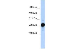 WB Suggested Anti-CSHL1 Antibody Titration:  0. (CSHL1 Antikörper  (C-Term))