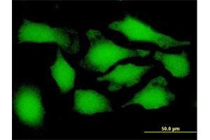 Immunofluorescence (IF) image for anti-Proteasome (Prosome, Macropain) 26S Subunit, Non-ATPase, 9 (PSMD9) (AA 1-223) antibody (ABIN948341)