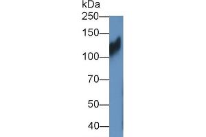 Detection of ITGb1 in HT1080 cell lysate using Polyclonal Antibody to Integrin Beta 1 (ITGb1) (ITGB1 Antikörper  (AA 454-714))