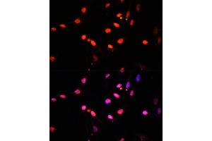 Immunofluorescence analysis of U2OS cells using KDM6B antibody (ABIN6131823, ABIN6142806, ABIN6142809 and ABIN6216507) at dilution of 1:100. (Kdm6b Antikörper  (AA 265-450))