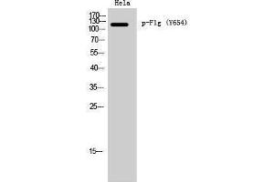 Western Blotting (WB) image for anti-Filaggrin (FLG) (pTyr654) antibody (ABIN3182416) (Filaggrin Antikörper  (pTyr654))