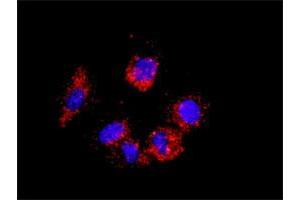 Proximity Ligation Assay (PLA) image for RICTOR & RPS6KB1 Protein Protein Interaction Antibody Pair (ABIN1340282)