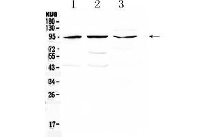 Western blot analysis of CD105 using anti- CD105 antibody . (Endoglin Antikörper  (Middle Region))