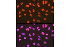 Immunofluorescence analysis of C6 cells using ENT2/SLC29 Rabbit mAb (ABIN7270448) at dilution of 1:100 (40x lens). (SLC29A2 Antikörper)