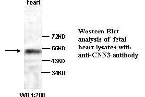Image no. 1 for anti-Calponin 3, Acidic (CNN3) (C-Term) antibody (ABIN790991) (CNN3 Antikörper  (C-Term))