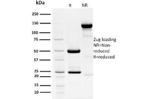 SDS-PAGE Analysis Purified HPV-18 Mouse Monoclonal Antibody (HPV16 E1/E4). (Human Papilloma Virus 16 E1, E4 (HPV-16 E1, E4) (AA 36-41) Antikörper)