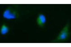 Image no. 1 for anti-Carbonic Anhydrase 12 (CA12) antibody (ABIN1497065)