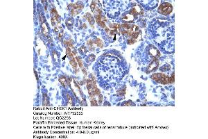 Human kidney (CHEK1 Antikörper  (Middle Region))