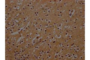 IHC image of ABIN7161274 diluted at 1:300 and staining in paraffin-embedded human brain tissue performed on a Leica BondTM system. (NEFH Antikörper  (AA 825-1003))