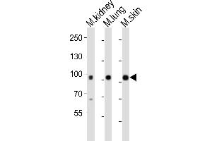 Western blot analysis of lysates from mouse kidney, mouse lung, mouse skin tissue (from left to right), using Epha1 Antibody (N-term) (ABIN6242303 and ABIN6577697). (EPHA1 Antikörper  (N-Term))