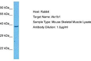 Host: Mouse Target Name: AKR1B1 Sample Tissue: Mouse Skeletal Muscle Antibody Dilution: 1ug/ml (AKR1B1 Antikörper  (N-Term))