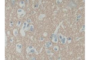 Immunohistochemistry (IHC) image for anti-Synaptosomal-Associated Protein, 25kDa (SNAP25) (AA 1-206) antibody (ABIN7443431)