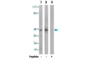 Western blot analysis of extracts from HepG2 cells (Lane 1) and K-562 cells (Lane 2 and 3), using PRKAR2B polyclonal antibody . (PRKAR2B Antikörper  (Ser113))