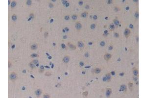 Detection of NT4 in Mouse Brain Tissue using Polyclonal Antibody to Neurotrophin 4 (NT4) (Neurotrophin 4 Antikörper  (AA 80-209))