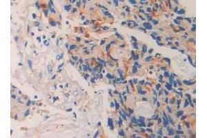 Immunohistochemistry (IHC) image for anti-Membrane Metallo-Endopeptidase (MME) (AA 382-538) antibody (ABIN7434053)