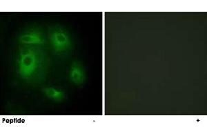 Immunofluorescence analysis of HeLa cells, using DLEC1 polyclonal antibody . (DLEC1 Antikörper  (N-Term))