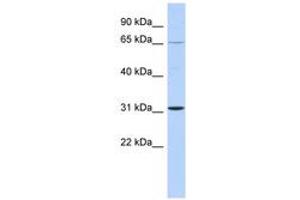 Image no. 1 for anti-Zinc Finger Protein 691 (ZNF691) (C-Term) antibody (ABIN6742831) (ZNF691 Antikörper  (C-Term))
