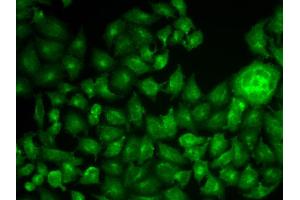 Immunofluorescence analysis of MCF-7 cell using CTTN antibody. (Cortactin Antikörper)
