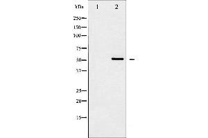 Western blot analysis of Src expression in HeLa whole cell lysates,The lane on the left is treated with the antigen-specific peptide. (Src Antikörper  (N-Term))