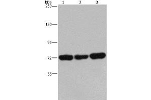 Western Blot analysis of 293T, Jurkat and Hela cell using PCK2 Polyclonal Antibody at dilution of 1:600 (PEPCK Antikörper)