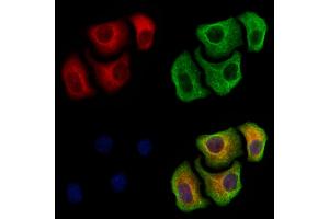 ABIN6265355 and ABIN6279867 staining Hela cells by IF/ICC. (Syntaxin 6 Antikörper  (Internal Region))