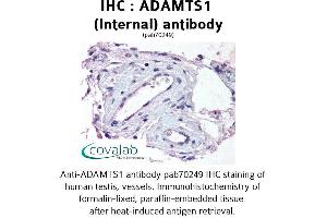 Image no. 1 for anti-ADAM Metallopeptidase with Thrombospondin Type 1 Motif, 1 (ADAMTS1) (Internal Region) antibody (ABIN1731522) (ADAMTS1 Antikörper  (Internal Region))