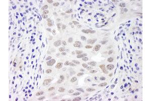 anti-Chromosome 11 Open Reading Frame 30 (C11orf30) (C-Term) antibody