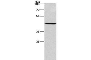 Western Blot analysis of Hela cell using BGN Polyclonal Antibody at dilution of 1:550 (Biglycan Antikörper)