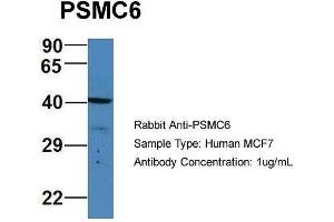 Western Blotting (WB) image for anti-Proteasome (Prosome, Macropain) 26S Subunit, ATPase, 6 (PSMC6) (C-Term) antibody (ABIN2788038)