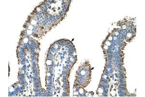 MMP1 antibody was used for immunohistochemistry at a concentration of 4-8 ug/ml to stain Epithelial cells of intestinal villus (arrows) in Human Intestine. (MMP1 Antikörper)