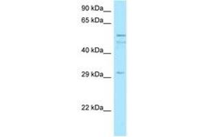 Image no. 1 for anti-Chromosome 11 Open Reading Frame 42 (C11ORF42) (AA 259-308) antibody (ABIN6747983) (C11ORF42 Antikörper  (AA 259-308))