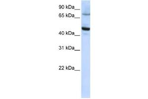 Western Blotting (WB) image for anti-Cytochrome P450, Family 46, Subfamily A, Polypeptide 1 (CYP46A1) antibody (ABIN2458770)