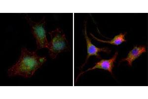 Immunofluorescence analysis of A549 (left) and SK-BR-3 (right) cells using CTNNB1 mouse mAb (green). (CTNNB1 Antikörper)