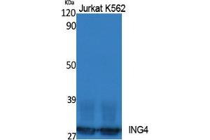 Western Blotting (WB) image for anti-Inhibitor of Growth Family, Member 4 (ING4) (Internal Region) antibody (ABIN3187605) (ING4 Antikörper  (Internal Region))