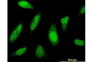 Immunofluorescence of monoclonal antibody to PTTG1IP on HeLa cell. (PTTG1IP Antikörper  (AA 1-180))