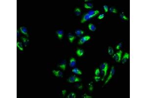 Immunofluorescence staining of Hela cells with ABIN7171142 at 1:66, counter-stained with DAPI. (SNAP23 Antikörper  (AA 90-196))