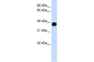 WB Suggested Anti-DEGS1 Antibody Titration:  0. (DEGS1 Antikörper  (N-Term))