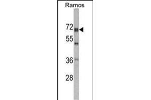 Western blot analysis of DDX5 antibody (Center) (ABIN391669 and ABIN2841580) in Romas cell line lysates (35 μg/lane). (DDX5 Antikörper  (AA 306-334))