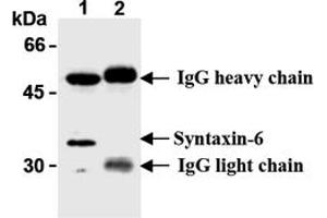 Western Blotting (WB) image for anti-Syntaxin 6 (STX6) antibody (ABIN492572) (Syntaxin 6 Antikörper)